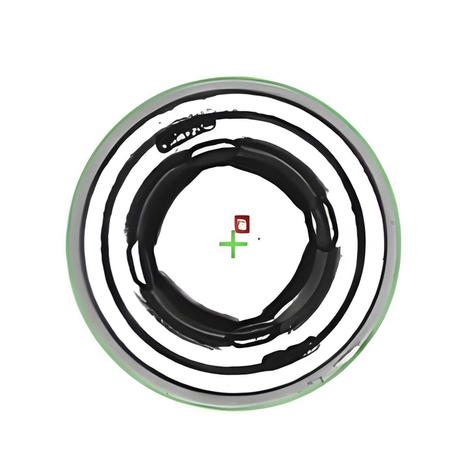 Compression Injury On The Convex Surface Of The Battery Cap